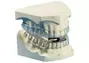 Mandibular Advancement Appliance Dentist South Africa