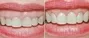 Periodontal Plastic Surgery Dentist South Africa