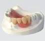 Acrylic Partial Denture Service In South Africa